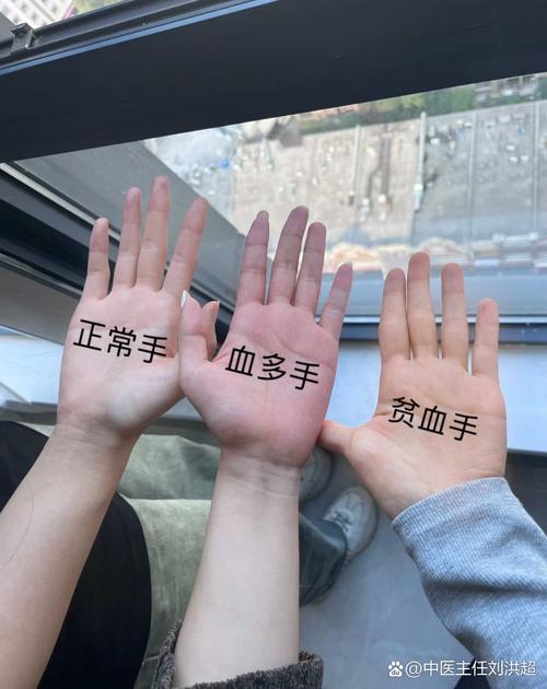 为什么手掌发红？四种疾病需及时就医检查！