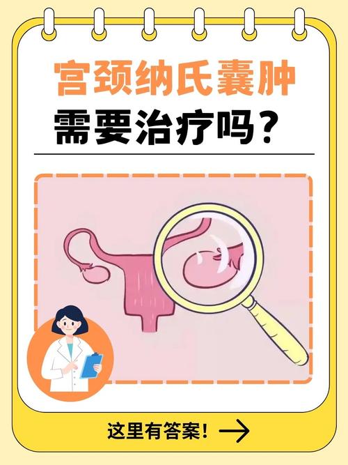宫颈红警囊肿的预防和治疗，你需要知道的都在这里