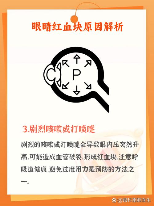 警惕！红警游戏或致眼部损伤，如何避免？