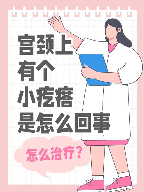 宫颈红警囊肿的预防和治疗，你需要知道的都在这里